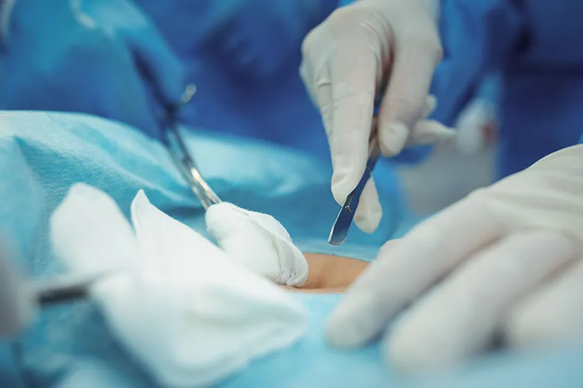 image of a liver surgery