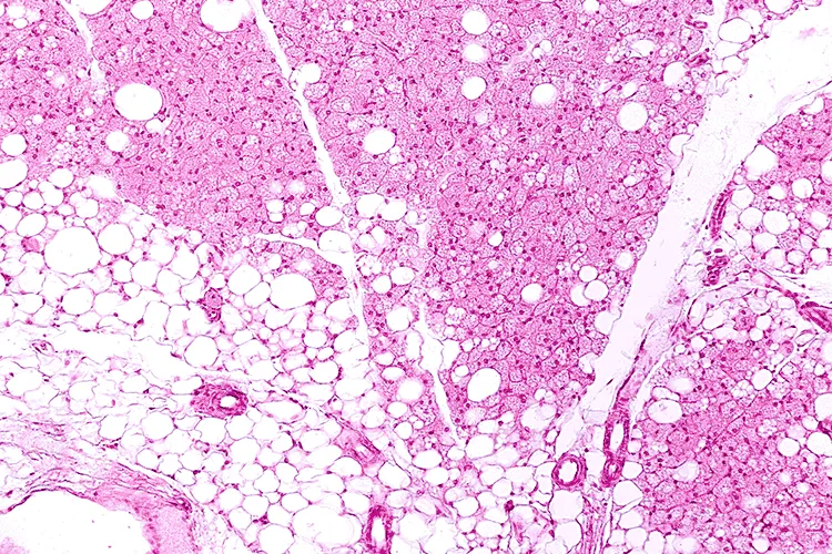 micrograph showing white and brown fat