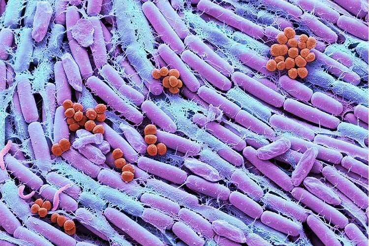 Color scanning electron micrograph of a culture of breast milk showing some bacteria.