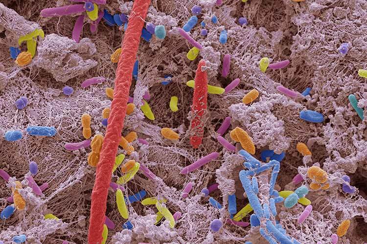 Coloured scanning electron micrograph of oral bacteria