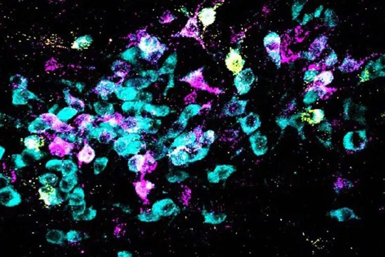 Mouse neurons seen under the microscope