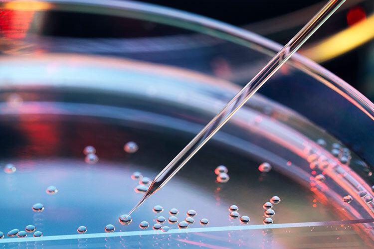 A photograph showing a syringe collecting stem cells