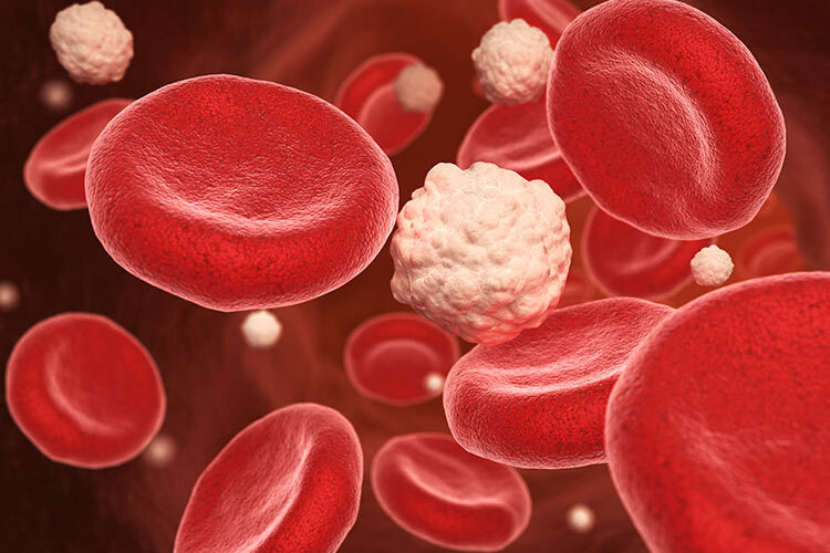 The image shows a representation of blood sugar molecules, a key factor in diabetes