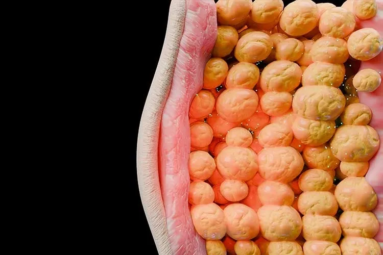 tejido adiposo, grasa