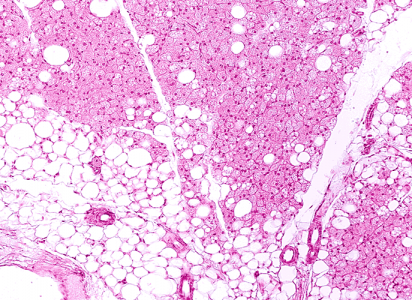 micrograph showing white and brown fat