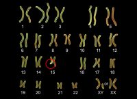 Illustration of human chromosomes, with a red circle pointing at chromosome 15