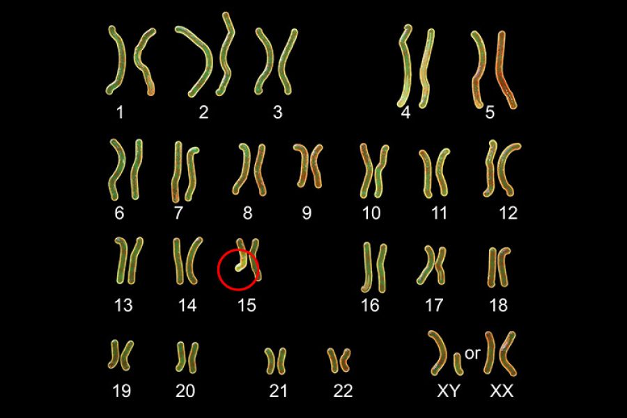 Illustration of human chromosomes, with a red circle pointing at chromosome 15