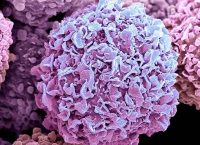 Breast Cancer Cells