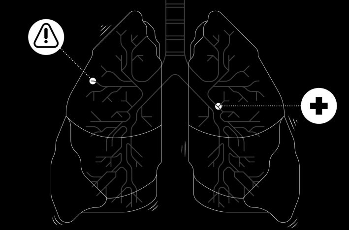 Lungs illustrated with black background.