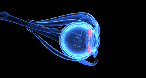 corneal structure on computerized image
