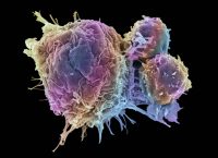 T-lymphocytes and cancer cells