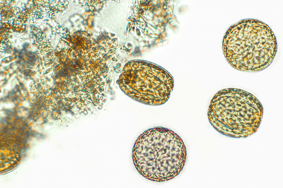 microalgae close up