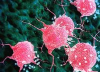 Image of Breast Cancer Cells