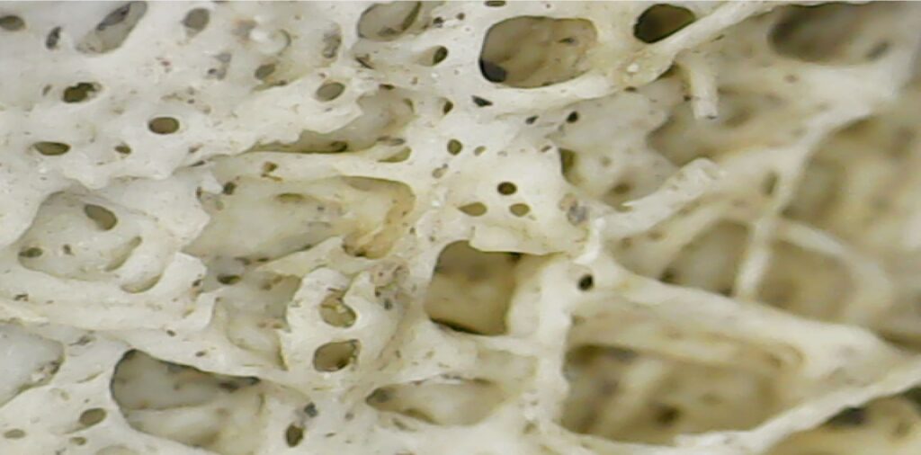 imagen microscópica del interior de un tronco