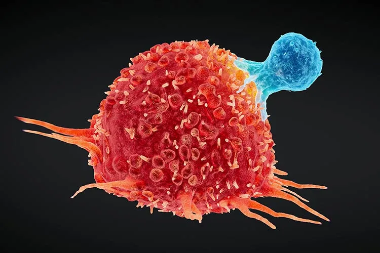 Imagen de célula cancerígena atacada por célula T humana