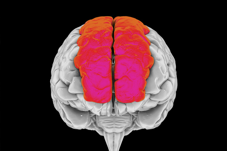 En esta ilustración vemos el cerebro humano con circunvoluciones frontales superiores resaltadas, también conocidas como circunvoluciones marginales. Se encuentra en el lóbulo frontal y se asocia con la autoconciencia y la risa