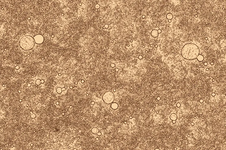 Fotografía a color de la leche materna vista a través de un microscopio