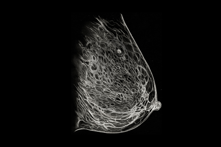 Ilustración en blanco y negro de una mamografía