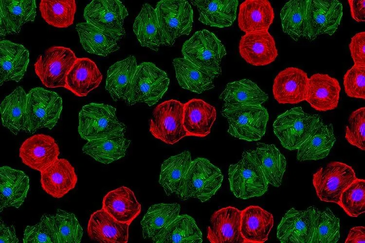 Células de cerdo editadas genéticamente para xenotrasplante en humanos.