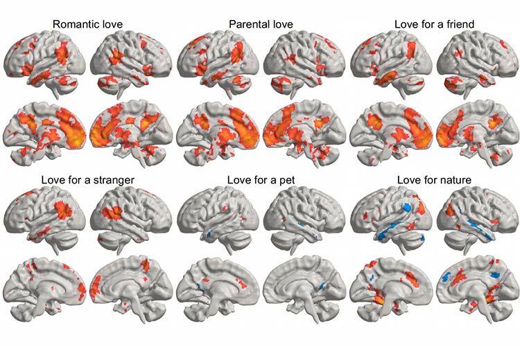 resonancia magnética que representa cómo se estimula el cerebro respecto al amor