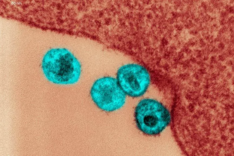 Fotografía microscópica del virus de inmunodeficiencia humana (VIH)