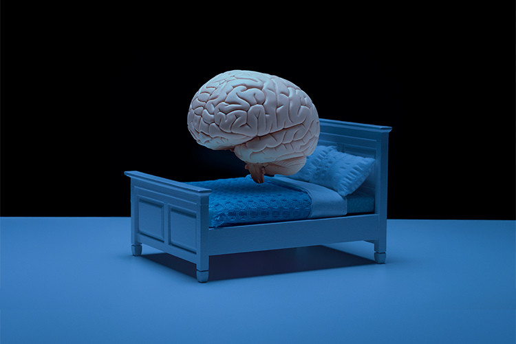 imagen de un cerebro en cama