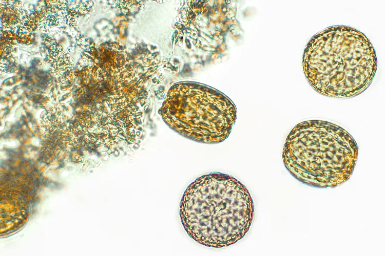 En la imagen un acercamiento a las microalgas