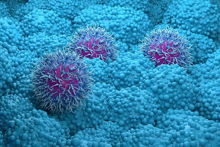 ilustracion de cancer en las células