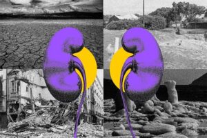 Fotoarte que muestra un par de riñones de color morado frente a un escenario árido y con falta de agua