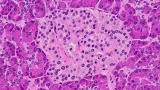 Fotografía microscópica de un islote pancreático