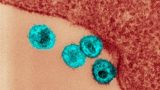 Fotografía microscópica del virus de inmunodeficiencia humana (VIH)