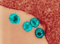 Fotografía microscópica del virus de inmunodeficiencia humana (VIH)