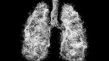 Ilustración en blanco y negro de dos pulmones llenos de humo