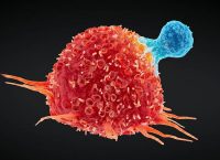 Imagen de célula cancerígena atacada por célula T humana