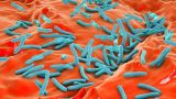 Tuberculosis bacteria