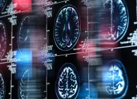 riesgo genético de alzhéimer