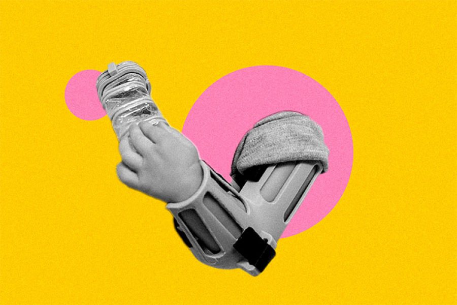 Ilustración del brazo de un bebé con el dispositivo DINA sobre fondo amarillo y rosa.