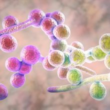 Se ve una ilustración por computadora del hongo Sandida albicans