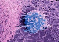 Imagen de una célula cancerígena de próstata