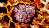 El conocimiento sobre la biología de los tumores ha permitido el desarrollo de terapias dirigidas que actúan sobre las células cancerosas. (Foto: Getty Images)