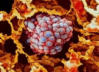 El conocimiento sobre la biología de los tumores ha permitido el desarrollo de terapias dirigidas que actúan sobre las células cancerosas. (Foto: Getty Images)