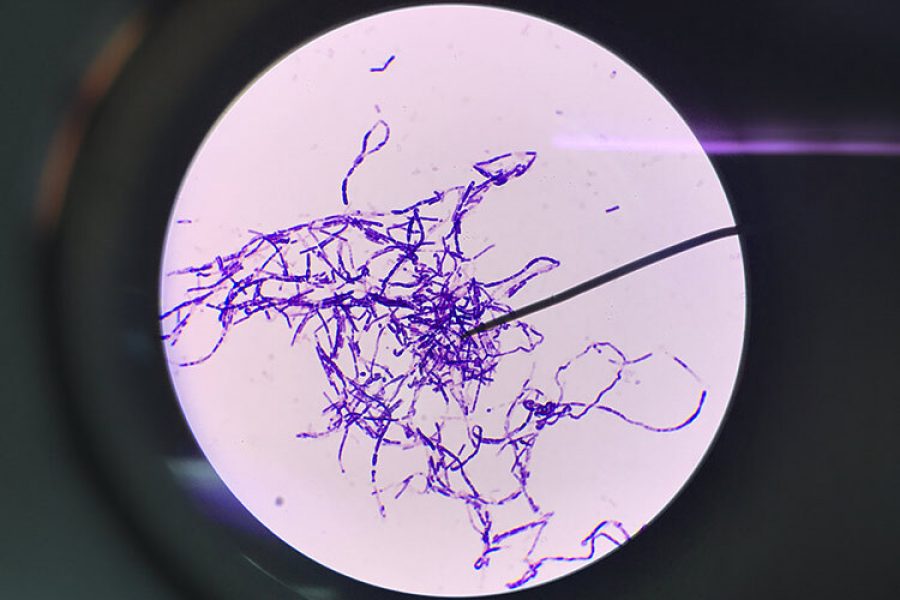 bacillus subtilis gram stain 1000x