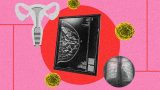 Fotoarte enelque se ve una pantalla con la radiografía de un seno y a la izquierda ilustración de trompas de falopio y a la derecha una radiografía de pulmones