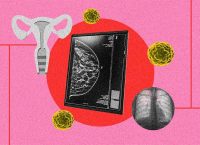 Fotoarte enelque se ve una pantalla con la radiografía de un seno y a la izquierda ilustración de trompas de falopio y a la derecha una radiografía de pulmones