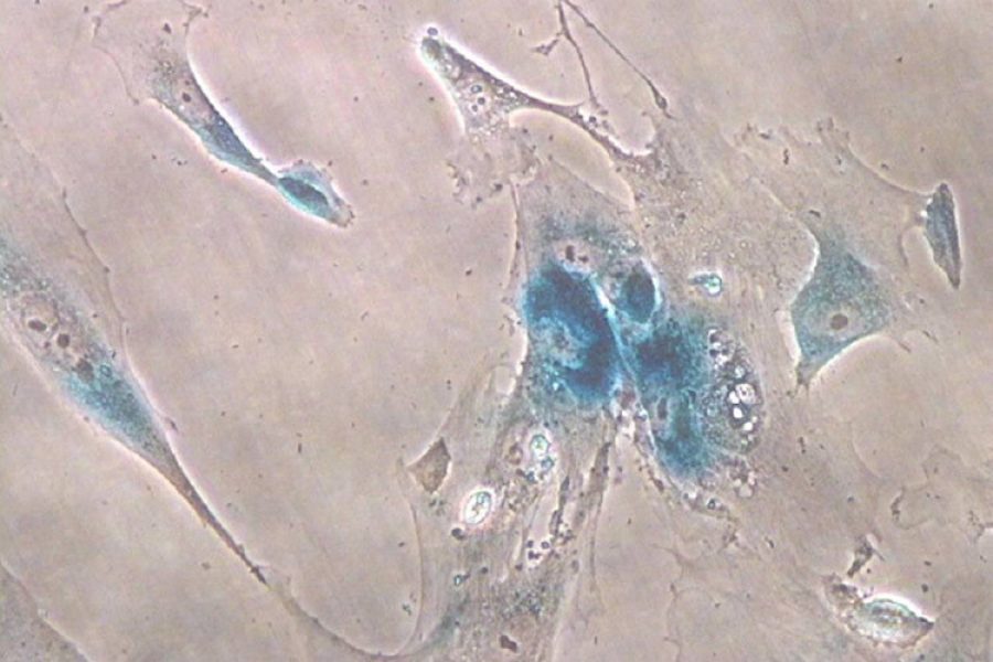 Imagen de microscopía de células senescentes.