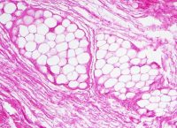 fat-tissue