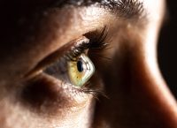 cornea con deformación por queratocono