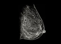 Ilustración en blanco y negro de una mamografía