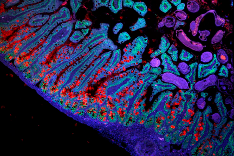 intestino delgado atlas celulas