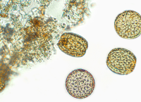 En la imagen un acercamiento a las microalgas